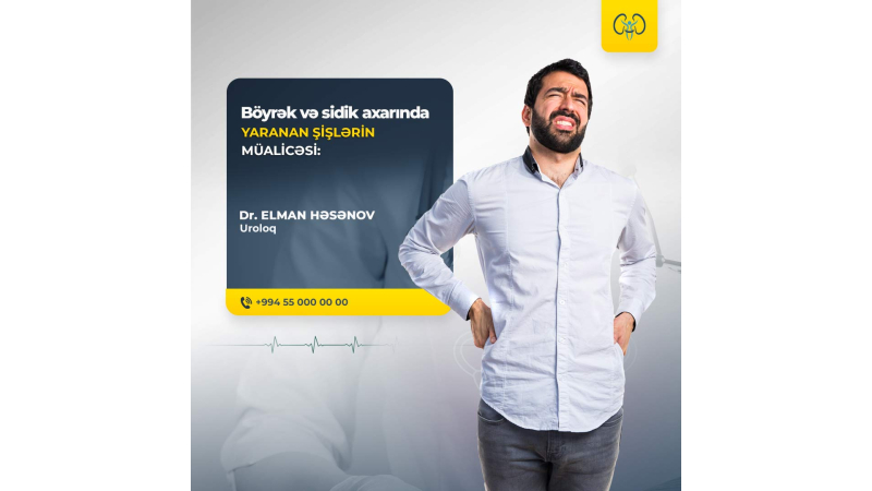 Urologiya dizaynları | Uroloqlar üçün poster dizaynları Urologiya dizaynları | Uroloqlar üçün poster dizaynları