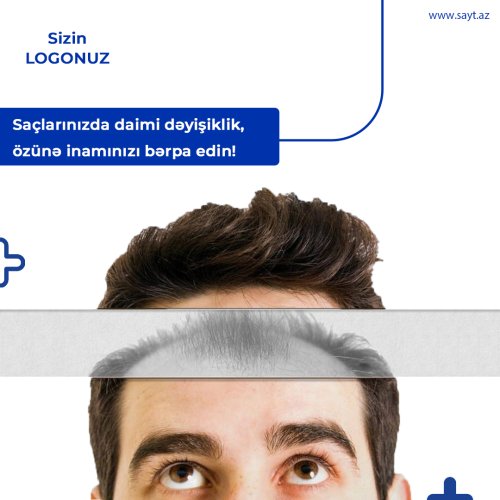 Saç əkimi post dizaynları, medical postların sifarişi, tibb sahəsi paylaşımı