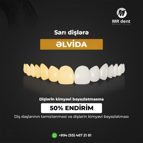 Stomatologiya dizaynları, Diş həkimləri üçün poster dizaynlar, Mr Dent stomatologiya postları, instagram dizaynları